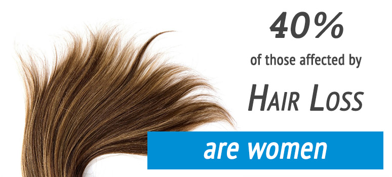 Female Hair Loss