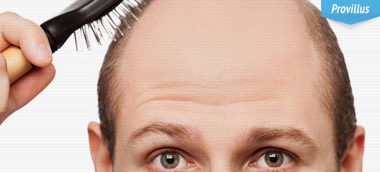 Treatment for Hair Loss