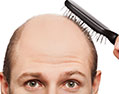 Bizarre baldness cures