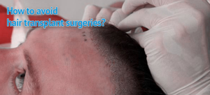 Avoid hair transplant surgeries