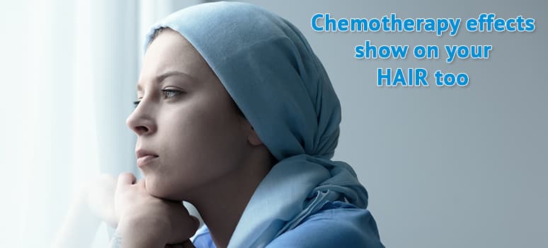 Chemotherapy effects on hair
